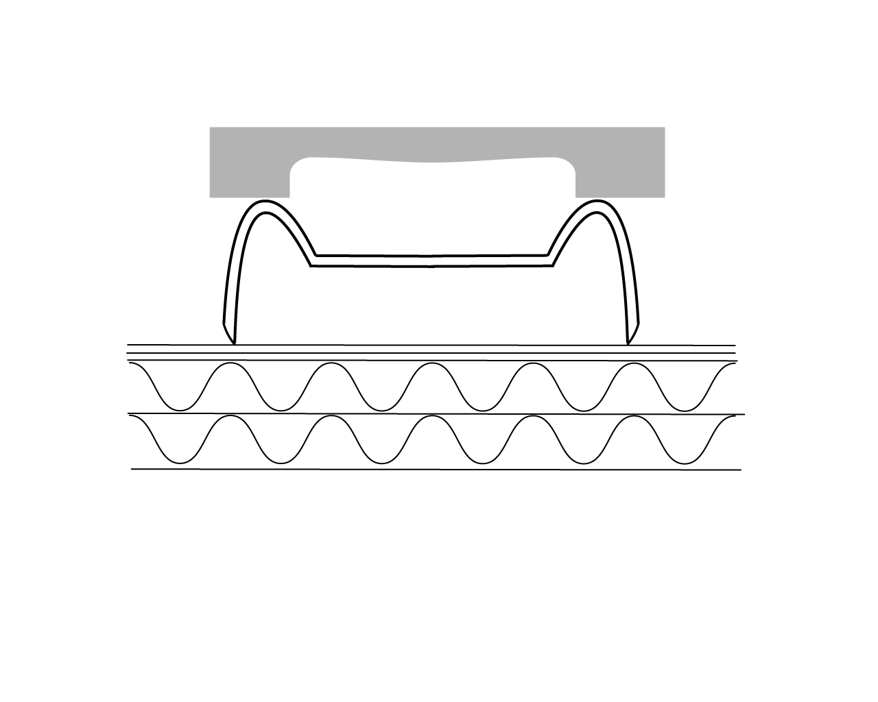 Klammernverschluss