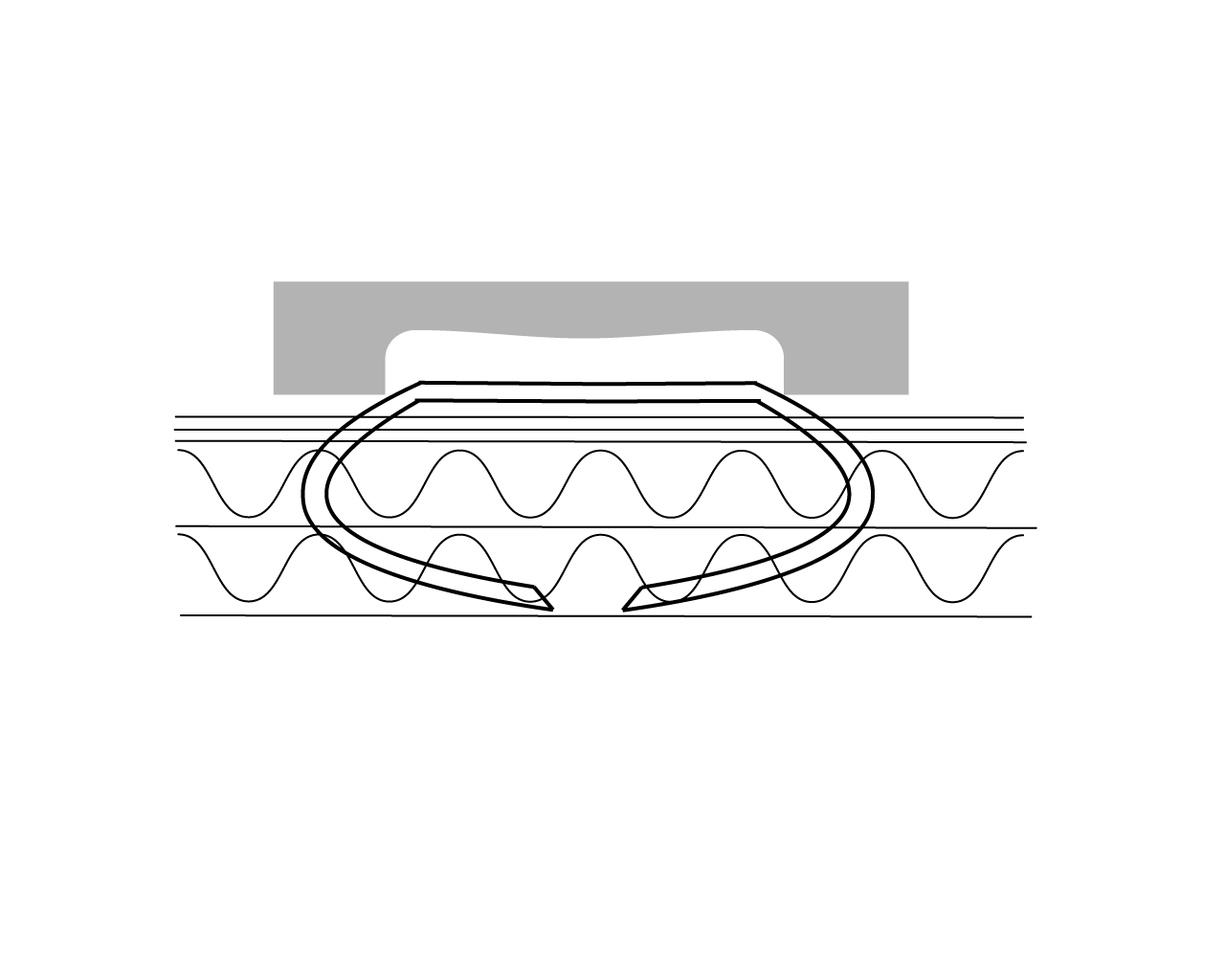 Klammernverschluss 2